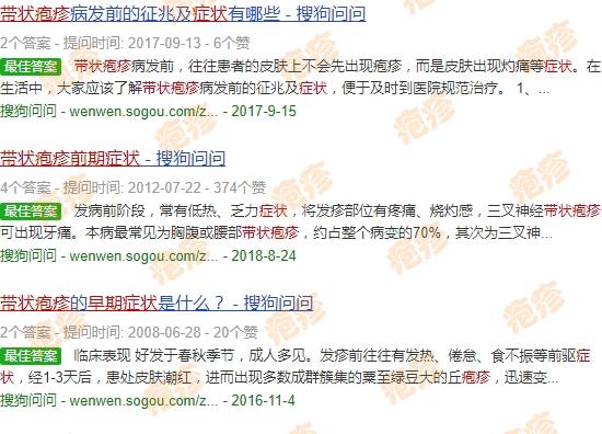 汕头带状疱疹苗接种 - 汕头带状疱疹图片初期症状