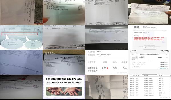 汕头抽血化验梅毒多久出结果啊 - 汕头抽血化验梅毒多久出结果