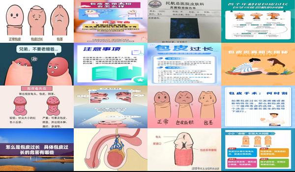 包皮会影响生孩子吗? - 汕头包皮会不会影响性生活