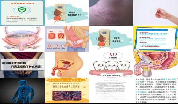 汕头泌尿科医院在哪里 - 汕头急性的尿道炎症要怎么治疗法