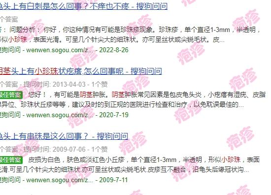 汕头有男性男科医院吗 - 汕头阴茎有带毛的小珍珠是疱疹吗