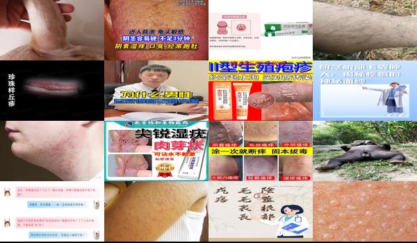汕头有男性男科医院吗 - 汕头阴茎有带毛的小珍珠是疱疹吗