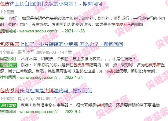 包皮系带 尖锐 - 汕头尖锐长包皮系带