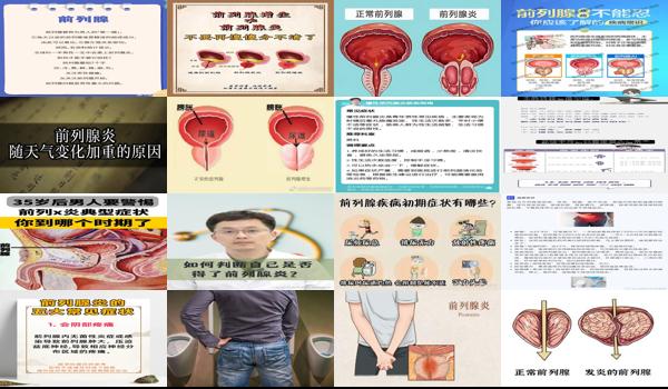 汕头哪里看前列腺炎好 - 汕头男人前列腺炎症状表现哪些症状