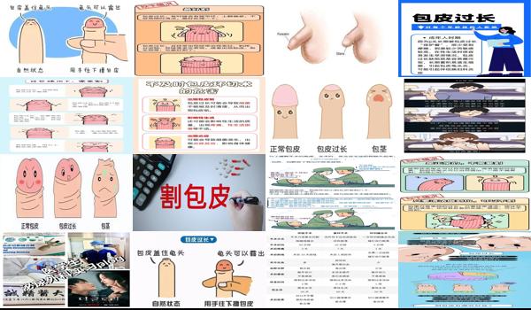 汕头割包皮要多少钱 - 汕头割包皮对人体有害吗