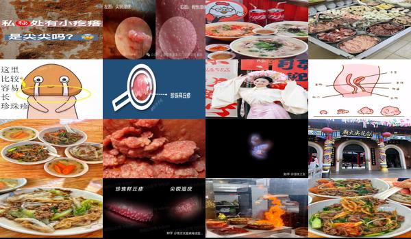 下体有小疙瘩是尖锐吗 - 汕头下体长了很多小颗粒是尖锐