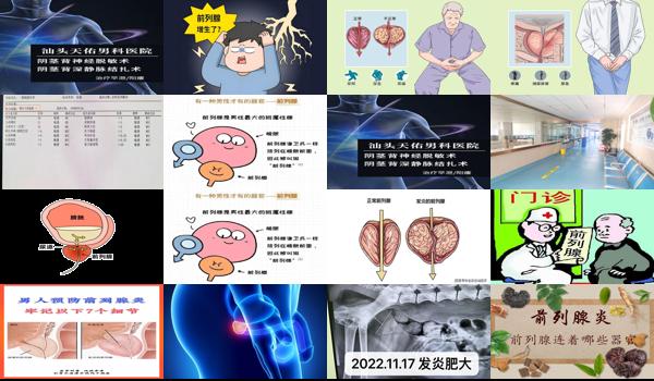 汕头前列腺发炎治疗医院 - 汕头前列腺发炎治疗