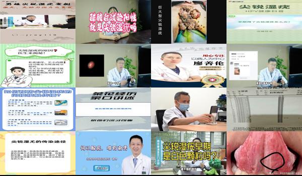 汕头治疗尖锐*好的医院 - 汕头尖锐湿疣在线医生咨询