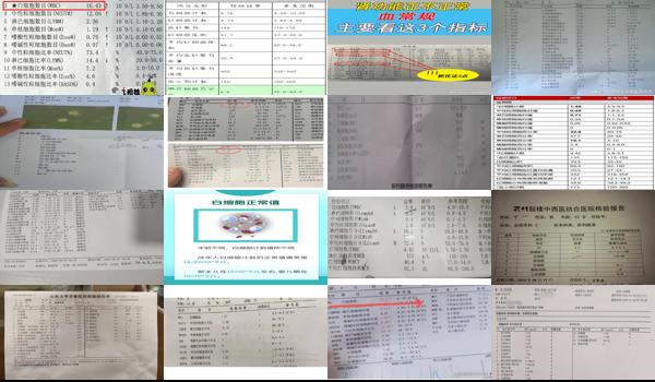 前列腺常规白细胞多少正常 - 汕头前列腺常规白细胞正常值