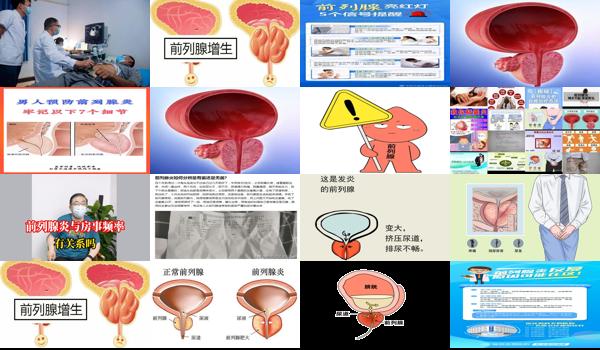 汕头市前列腺主治* - 汕头前列腺发炎是什么引起的
