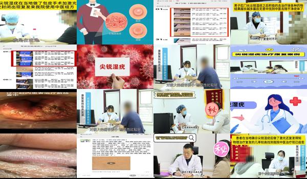 尖湿锐尤割包皮 - 汕头尖锐湿尤激光引起包皮水肿