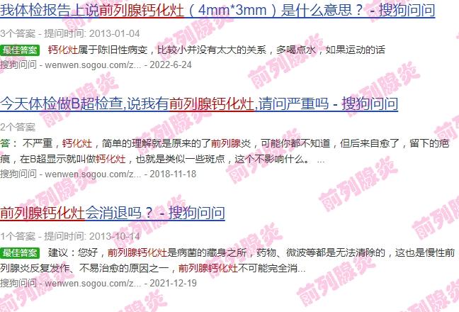 26岁前列腺钙化灶 - 汕头28岁前列腺钙化灶