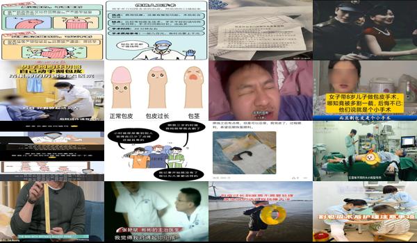 包皮割了4年后悔了图片 - 汕头包皮割了4年后悔了