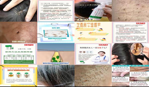 男性阴囊有虱子怎么根除 - 汕头男人阴囊有阴虱怎么办