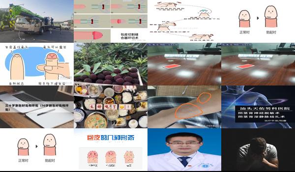 包皮过短手术多少钱 - 汕头包皮太短