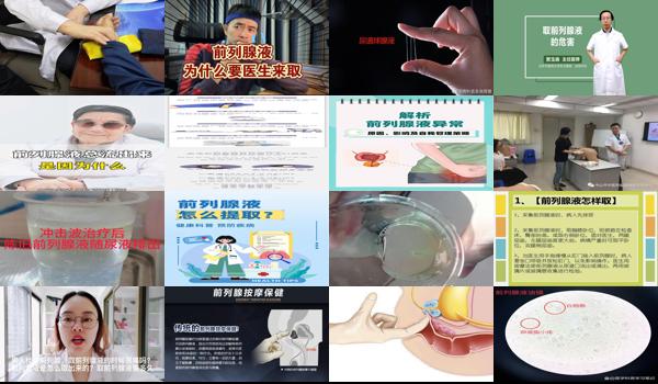 取前列腺液的经验 - 汕头取前列腺液的方法