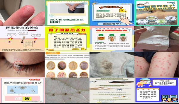 怎么检查是不是阴虱 - 汕头如何判断自己是不是阴虱