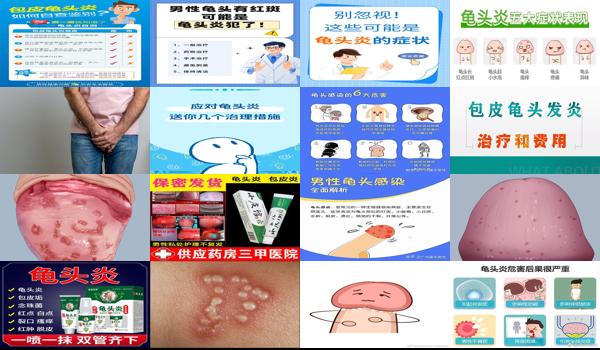 汕头龟的图片 - 汕头龟头炎症状 百度网盘