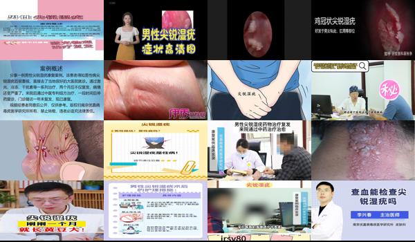 汕头男性*医院哪里比较好 - 汕头男性尖锐湿疣能自愈吗