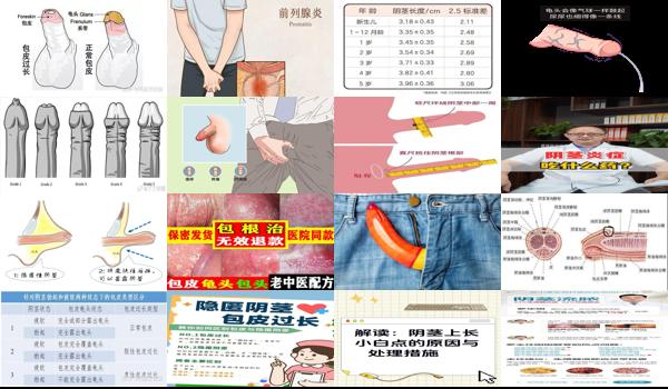 汕头怎样 - 汕头怎么判断阴茎会炎症