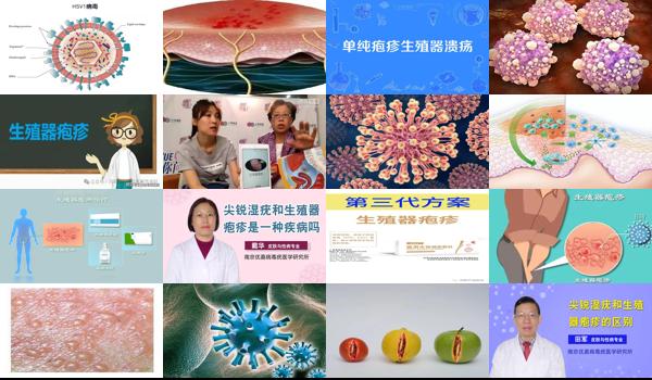 汕头生殖医院 - 汕头生殖器疱疹严重的情况下会怎么样