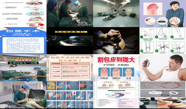 汕头包皮手术多少钱 - 汕头包皮手术要多久
