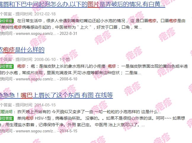 嘴巴头长疱疹 - 汕头嘴巴疱疹图片