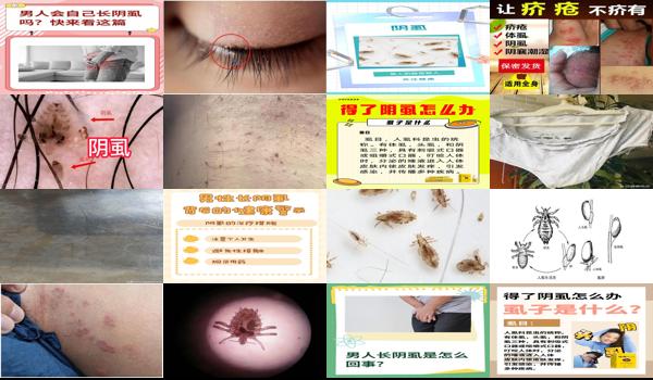 男阴长虱子病怎么来的 - 汕头男性长阴虱是怎么回事