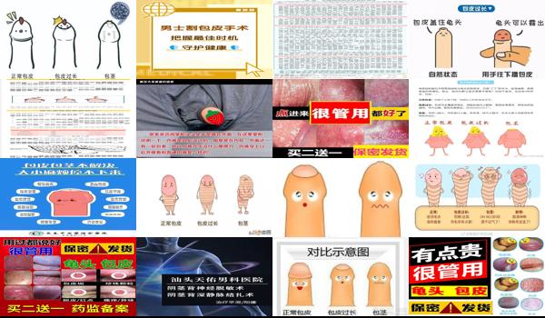 汕头男士包皮手术医院 - 汕头男士包皮