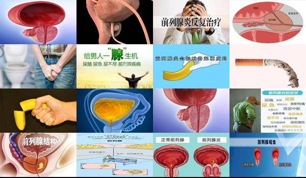 前列腺炎会影响男性功能吗 - 汕头前列腺炎会不会影响勃起