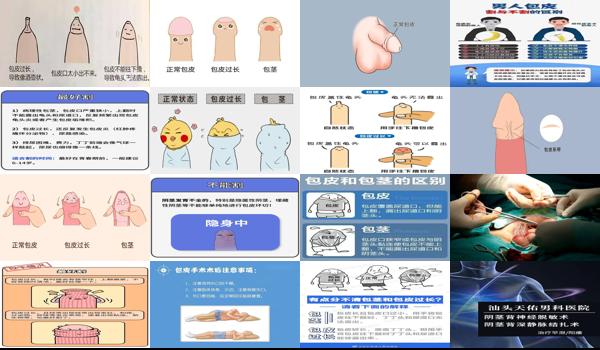 汕头男性 - 汕头男人正常包皮图片