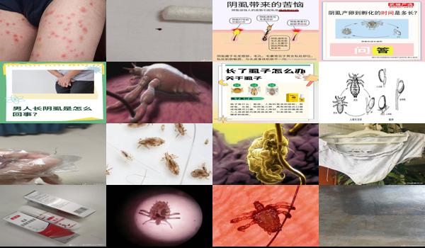 阴虱找不到了还痒 - 汕头阴虱找不到了是不是*是没了