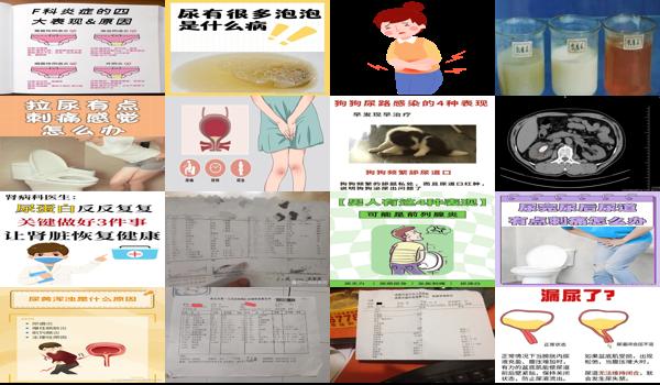 尿有炎症是什么原因 - 汕头尿有炎症是为什么