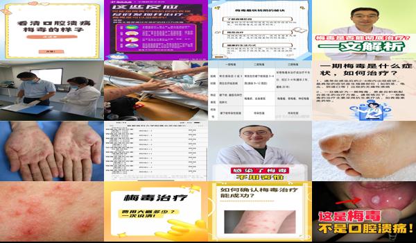 汕头梅毒治疗医院 - 汕头梅毒的治疗方法