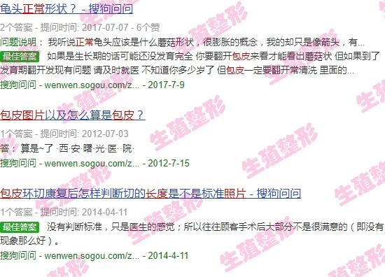 汕头做包茎手术哪里好点 - 汕头正常包皮长度图片