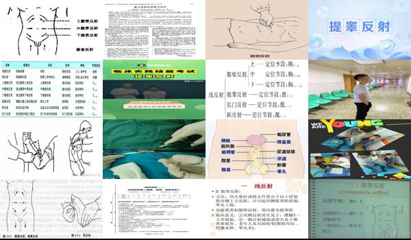 什么是提睾反射? - 汕头提睾反射反应性功能障碍