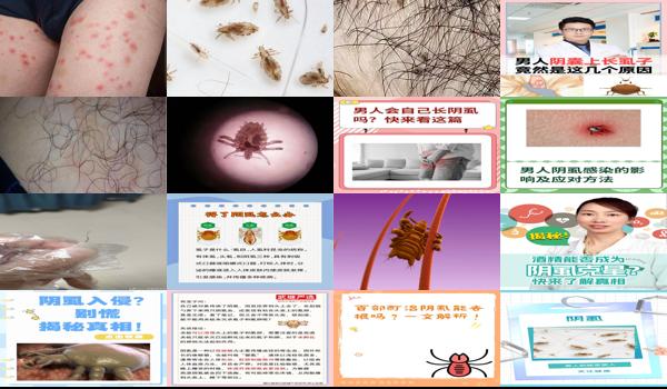 男人生阴虱虫和女人有关吗 - 汕头男人会生阴虱吗