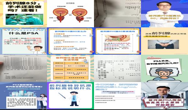 前列腺检查偏高 - 汕头前列腺指标高怎么回事