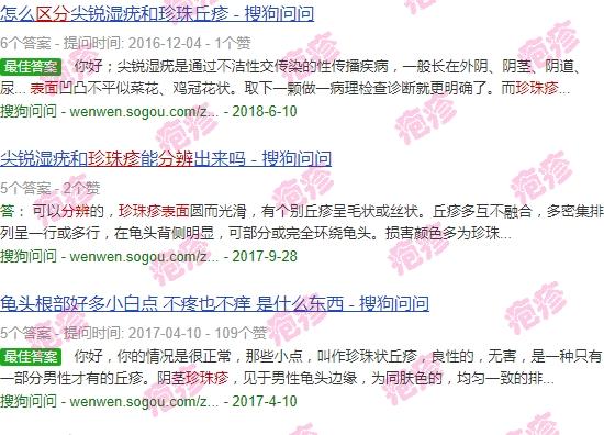 珍珠疹属于疱疹吗 - 汕头珍珠疹与疱疹外表区分