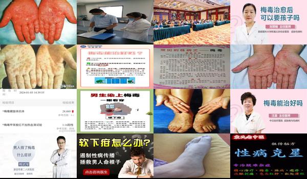 汕头市治梅毒医院哪家好 - 汕头市治梅毒医院