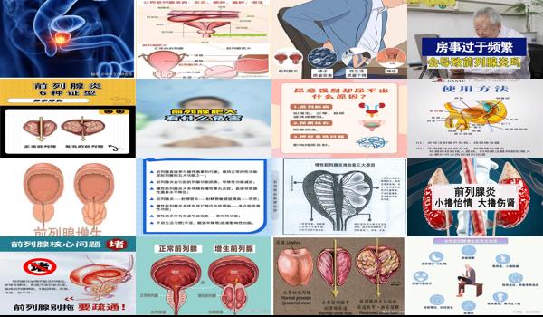 汕头前列腺炎肥大与阻塞治疗医院 - 汕头前列腺炎肥大与阻塞