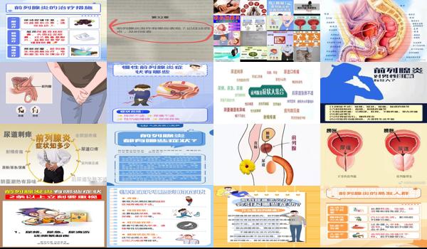 汕头哪里看前列腺炎好 - 汕头男前列腺炎症状有哪些
