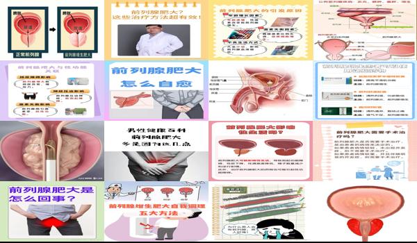 前列腺肥大能看好吗? - 汕头前列腺肥大么