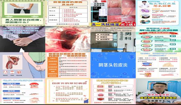 阴劲炎症是什么症状 - 汕头阴经炎症是怎么隐起的