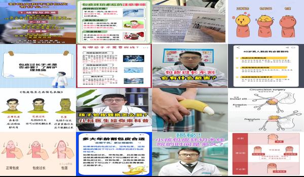 汕头割包皮哪里好 - 汕头包皮有必要割吗
