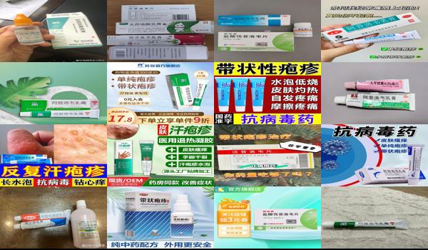 头部疱疹用药 - 汕头疱疹用什么药