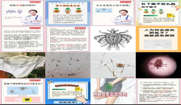 天天都洗澡怎么会得阴虱 - 汕头天天洗澡怎么会有阴虱