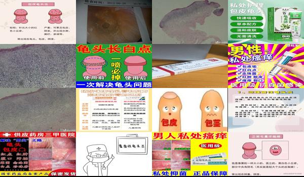 霉菌性龟炎的常见症状 - 汕头霉菌引起的龟头炎症状