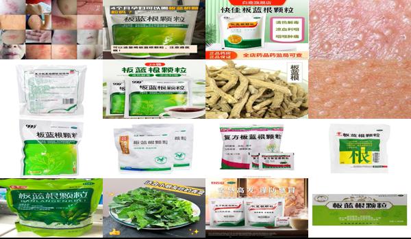 板蓝根颗粒可以治疗疱疹吗? - 汕头阴茎疱疹吃板蓝根颗粒有没有用