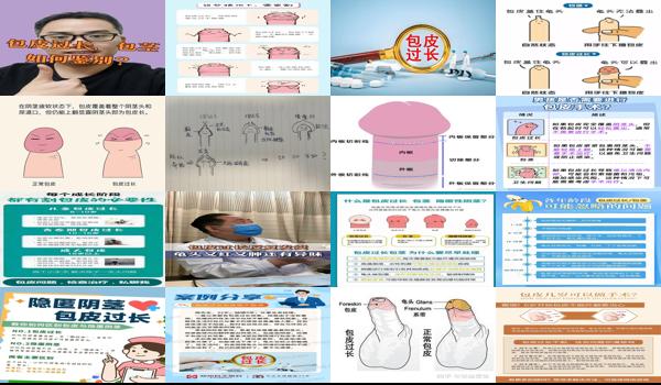汕头包皮手术多少钱 - 汕头包皮过长是什么原因